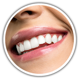 Why Choose Professional Teeth Whitening? | Katy | Cinco Ranch